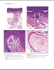 Sách Dermatopathology: diagnosis by first impression