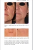 Sách handbook of Lasers in Dermatology