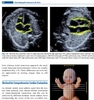 Sách echocardiographic anatomy in the fetus