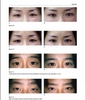 Sách asian facial cosmetic surgery