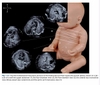 Sách echocardiographic anatomy in the fetus