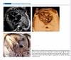 Sách echocardiographic anatomy in the fetus