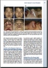 Sách   rhinoplasty  for the Asian Nose, An Issue of Facial Plastic Surgery  Clinics of North America