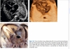 Sách echocardiographic anatomy in the fetus