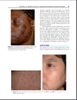 Sách Aesthetics and Cosmetic Surgery for Darker Skin Types