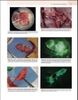 Sách  Principles and Practice of Lymphedema Surgery
