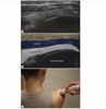 Sách practical musculoskeletal ultrasound 2nd edition