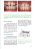 CHỈNH NHA CƠ BẢN TỪ NGUYÊN LÝ ĐẾN THỰC HÀNH