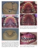 Chỉnh nha : Sổ tay lâm sàng về Mini-implant