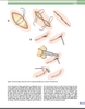 Sách Techniques in Ophthalmic Plastic Surgery: A Personal Tutorial