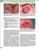 Sách Techniques in Ophthalmic Plastic Surgery: A Personal Tutorial