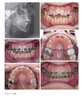 Chỉnh nha : Sổ tay lâm sàng về Mini-implant