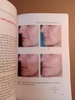 ATLAS MESOTHERAPY