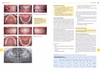 Sách mắc cài tự buộc trong chỉnh nha