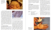 Sách botulinum Toxin for Asians-Springer Singapore (2017)
