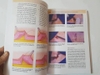 Sách Atlas of Suturing Techniques: Approaches to Surgical Wound, Laceration, and Cosmetic Repair