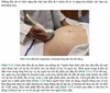 Sách siêu âm trong sản khoa và phụ khoa một cách tiếp cận thức tế .Sách bìa cứng