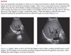 Sách ma and mateer's emergency ultrasound