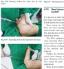 Sách liposuction 1st ed. 2018 edition