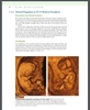 Sách atlas of ultrasound in obstetrics and gynecology: a multimedia reference second edition