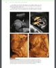 Sách atlas of ultrasound in obstetrics and gynecology: a multimedia reference second edition