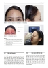 SÁCH KĨ THUẬT TIÊM FILLER AN TOÀN