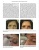 Sách Botulinum Toxins in Clinical Aesthetic Practice ( Botulinum Toxins trong thực hành thẩm mỹ lâm sàng )