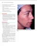 Color Atlas of Cosmetic Dermatology