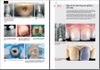 Sách điều trị lại trong nội nha