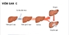 Chỉ định và điều trị viêm gan C