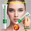 BEOTUA 20G- KEM HỖ TRỢ GIẢM MỤN KIỂM SOÁT DẦU THU NHỎ LỖ CHÂN LÔNG DƯỠNG ẨM LÀM TRẮNG DA HIỆU QUẢ