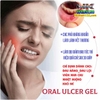 GEL LÀM DỊU GIẢM ĐAU RĂNG NHIỆT MIỆNG HIỆU QUẢ MOUTH ORAL ULCER 30GRAM