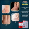 NỘI ĐỊA TRUNG [CHUẨN 100% HÀNG CTY]- HỘP ĐỎ KEM BÔI NẤM NGỨA,MỀ ĐAY, TỔ ĐỈA, HẮC LÀO, CHÀM NÁM, LANG BEN, BẠCH BIẾN...