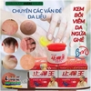 HŨ ĐỎ KEM BÔI BỌ CẠP THẦN Y-ĐẶC TRỊ NẤM NGỨA, GHẺ LỞ, HẮC LÀO, Á SỪNG, MỀ ĐAY, TỔ ĐỈA, VẢY NẾN