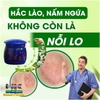HŨ XANH KEM BÔI BỌ CẠP THẦN Y-ĐẶC TRỊ NẤM NGỨA, GHẺ LỞ, HẮC LÀO, Á SỪNG, MỀ ĐAY, TỔ ĐỈA, VẢY NẾN