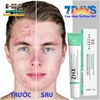KEM AXIT SALICYLIC ZHX 20GR- ĐẶC HIỆU GIẢM THIỂU TRỨNG CÁ TUỔI DẬY THÌ, GIÚP SE KHÍT LỖ CHÂN LÔNG DƯỠNG ẨM VÀ HỖ TRỢ GIẢM MỤN ĐẦU ĐEN HIỆU QUẢ