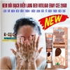 [CHUẨN 100% HÀNG CTY] KEM BÔI BẠCH BIẾN LANG BEN VITILIGO ERAY CEE-20GR- LÀM MỜ BẠCH BIẾN ĐỐM TRẮNG NÁM THÂM HIỆU QUẢ