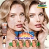 [CHUẨN 100% HÀNG CTY] KEM BÔI BẠCH BIẾN LANG BEN VITILIGO ERAY CEE-20GR- LÀM MỜ BẠCH BIẾN ĐỐM TRẮNG NÁM THÂM HIỆU QUẢ