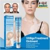 KEM BÔI BẠCH BIẾN LANG BEN VITILIGO SOUTH MOON-20GR [CHUẨN 100% HÀNG CTY]-TRỊ MỜ BẠCH BIẾN ĐỐM TRẮNG NÁM THÂM HIỆU QUẢ