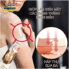 KEM BÔI BẠCH BIẾN LANG BEN VITILIGO SUMIFUN-20GR [CHUẨN 100% HÀNG CTY]-LÀM MỜ BẠCH BIẾN ĐỐM TRẮNG NÁM THÂM HIỆU QUẢ
