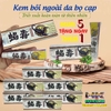[CHUẨN 100% HÀNG CTY] KEM BÔI DA LIỄU BỌ CẠP- ĐẶC TRỊ NẤM NGỨA, GHẺ LỞ, HẮC LÀO, Á SỪNG, MỀ ĐAY, TỔ ĐỈA, VẢY NẾN