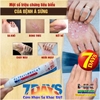 KEM BÔI ĐẶC TRỊ NẤM NGỨA VẢY NẾN Á SỪNG NHẬT BẢN [CHUẨN 100% HÀNG CTY]