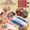 KEM BÔI ĐẶC TRỊ NẤM NGỨA VẢY NẾN Á SỪNG NHẬT BẢN [BẢN NỘI ĐỊA CHUẨN 100% HÀNG NK]