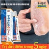 KEM BÔI ĐẶC TRỊ NẤM NGỨA VẢY NẾN Á SỪNG NHẬT BẢN [BẢN NỘI ĐỊA CHUẨN 100% HÀNG NK]