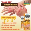 KEM BÔI NỌC ONG ĐẶC TRỊ NẤM NGỨA, MỤN NƯỚC HBESTY 20GR- CHO DA VIÊM, CHÀM ECZEMA,TỔ ĐỈA, VẨY NẾN Á SỪNG