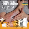 KEM BÔI NỌC ONG ĐẶC TRỊ NẤM NGỨA, MỤN NƯỚC HBESTY 20GR- CHO DA VIÊM, CHÀM ECZEMA,TỔ ĐỈA, VẨY NẾN Á SỪNG