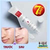 KEM DƯỠNG TRẮNG VÀ CHỐNG NHĂN HIISEES- DƯỠNG ẨM LÀM SÁNG CHO LÀN DA MỊN MÀNG TƯƠI TRẺ