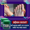 KEM GIẢM ĐAU SƯNG GOUT KHỚP NGÓN TAY VÀ NGÓN CHÂN PAIN RELIEF CREAM/GOUT OINTMENT/20G
