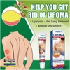 KEM LOẠI BỎ ĐÁNH TAN U MỠ BƯỚU CỔ HBESTY LIPOMA NODULAR 20GR- THẢO DƯỢC THIÊN NHIÊN