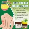 HŨ KEM THẢO MỘC LOẠI BỎ ĐÁNH TAN U MỠ BƯỚU CỔ SHOOTHING LIPOMA 20GR
